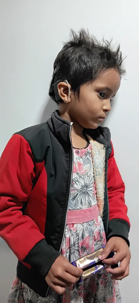 Cochlear Implant care at Satkriti Hospital, Varanasi