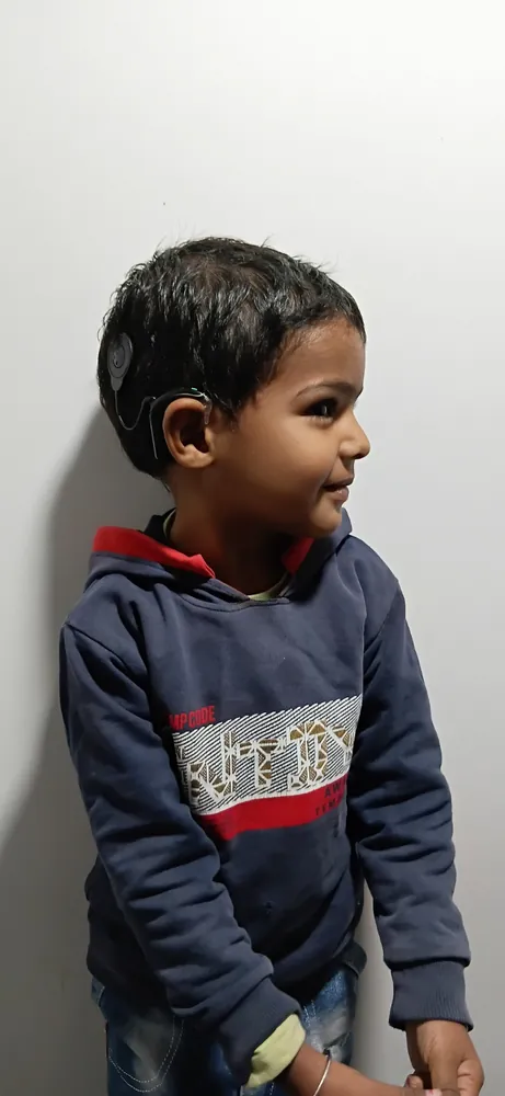 Cochlear Implant care at Satkriti Hospital, Varanasi