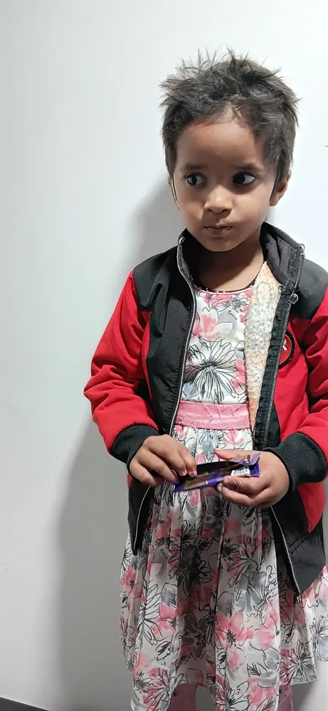 Cochlear Implant care at Satkriti Hospital, Varanasi