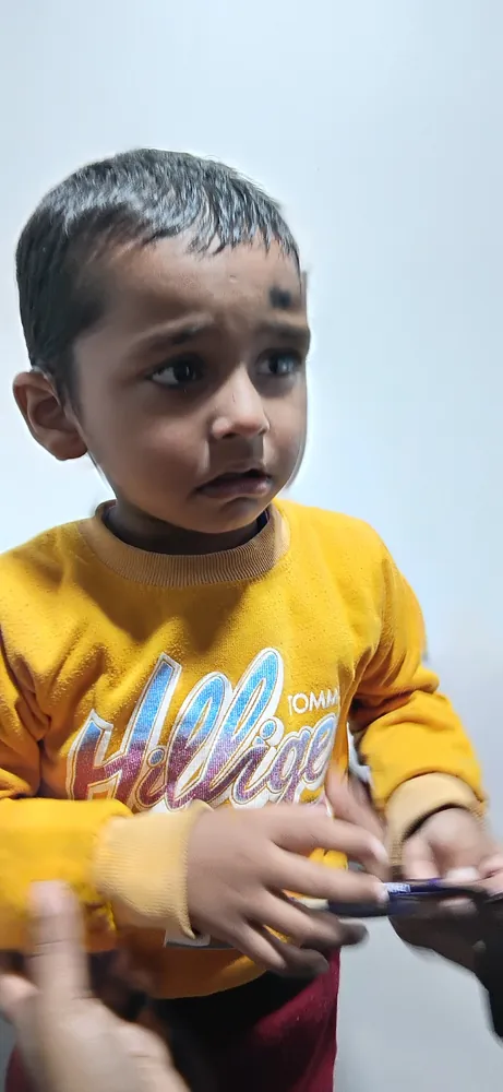 Cochlear Implant care at Satkriti Hospital, Varanasi