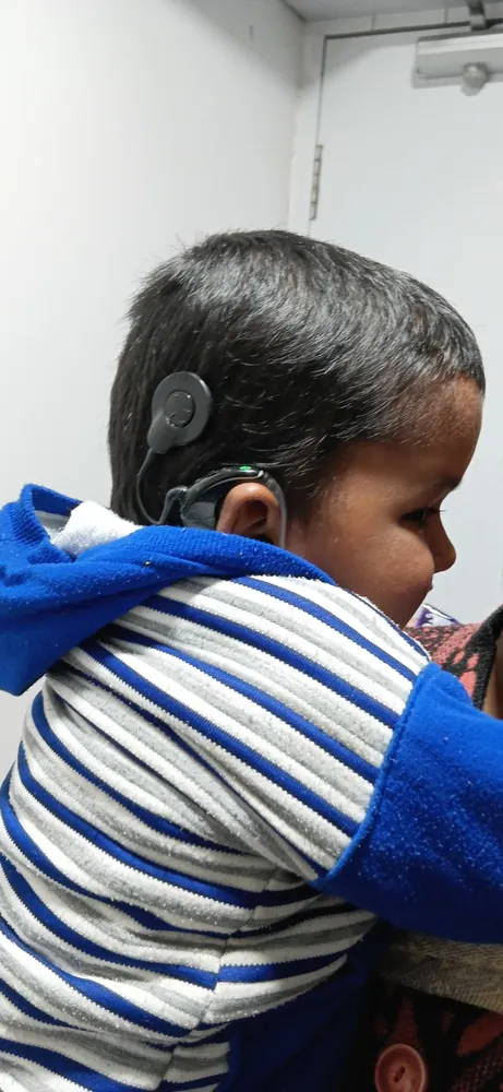 Cochlear Implant care at Satkriti Hospital, Varanasi