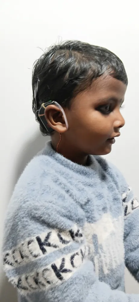 Cochlear Implant care at Satkriti Hospital, Varanasi — photo 6