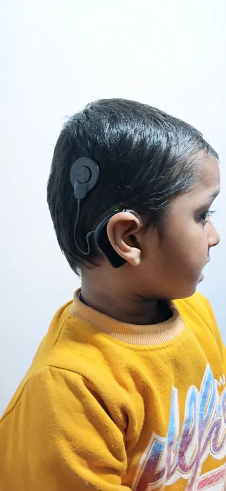 Cochlear Implant care at Satkriti Hospital, Varanasi — photo 8