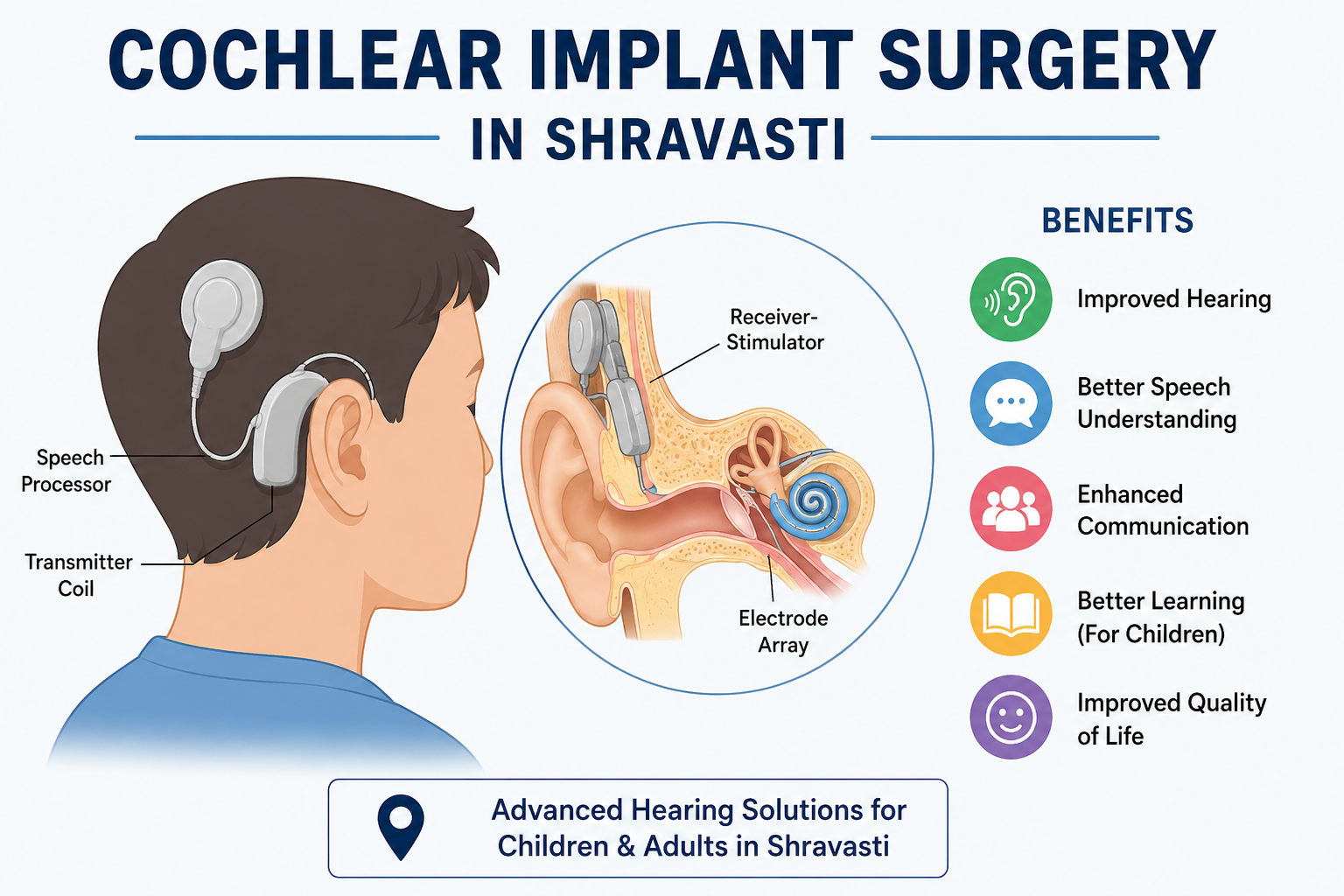 Cochlear Implant Surgery in Shravasti