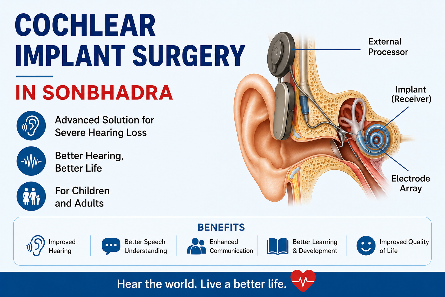 Cochlear Implant Surgery in Sonbhadra