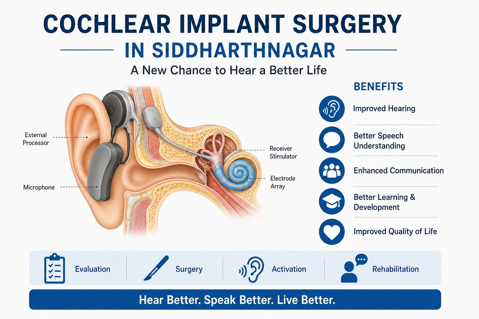 Cochlear Implant Surgery in Siddharthnagar